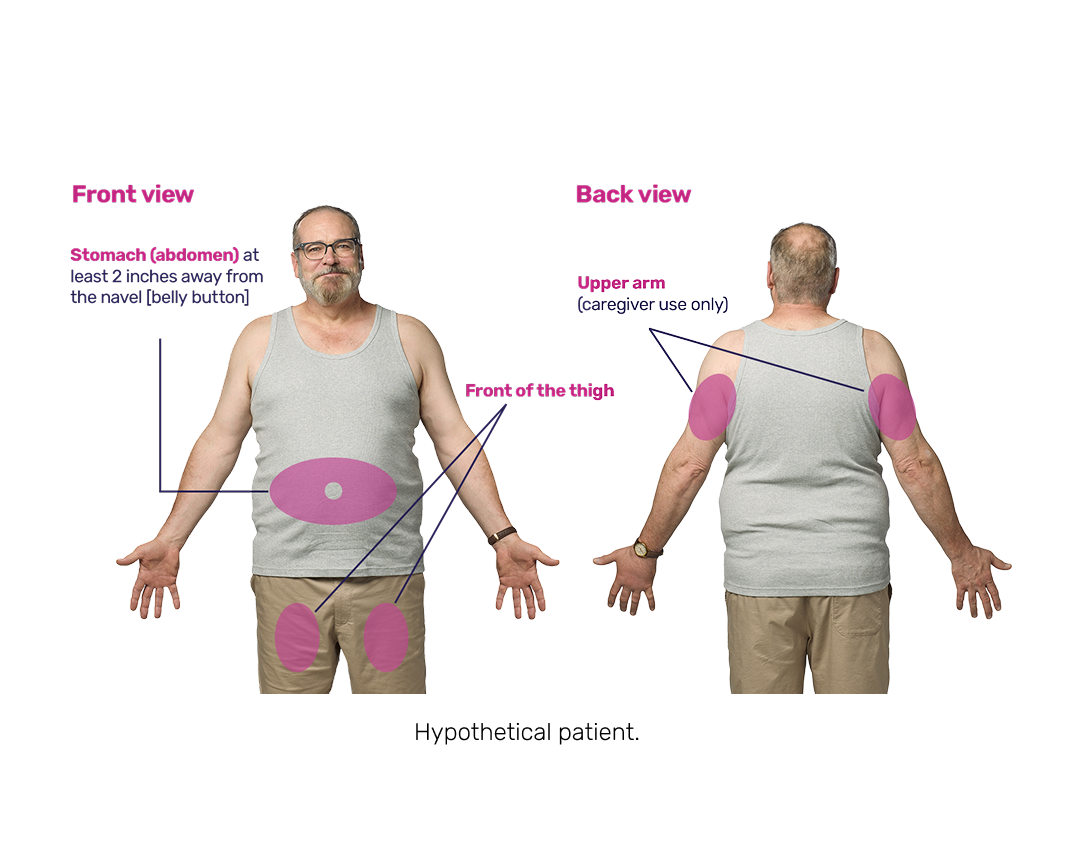 Infographic showing MIMRYLO injection sites: stomach (abdomen), at least 2 inches from navel (belly button); front of thigh; and outer area of upper arm (caregiver use only)